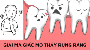 giải mã giấc mơ thấy rụng răng